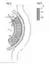 Fig. 06 - Infusion of drugs