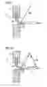 Fig. 08 - Infusion of drugs