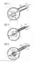 Fig. 12 - Stimulation of penis erection