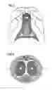 Fig. 02 - Stimulation of penis erection