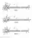 Fig. 02 - Fast-acting or rotating transseptal needle