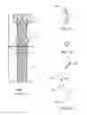 Fig. 02 - Laparoscopic instruments and trocar systems and related surgical method
