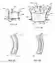 Fig. 04 - Laparoscopic instruments and trocar systems and related surgical method