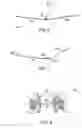 Fig. 05 - Laparoscopic instruments and trocar systems and related surgical method