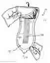 Fig. 01 - DISPOSABLE SANITARY ABSORBENT ARTICLE ASSEMBLY INCLUDING AN INTEGRATED DISPOSAL SHEET