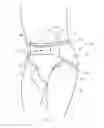 Fig. 02 - Two-piece wearable absorbent articles
