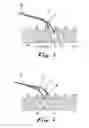 Fig. 05 - Drug delivery device