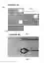 Fig. 09 - Catheter system providing step reduction for postconditioning