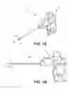 Fig. 02 - Suturing and repairing tissue using in vivo suture loading