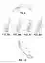 Fig. 06 - Suturing and repairing tissue using in vivo suture loading