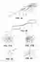 Fig. 08 - Suturing and repairing tissue using in vivo suture loading