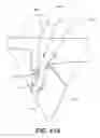 Fig. 30 - Suturing and repairing tissue using in vivo suture loading