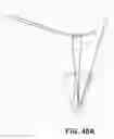 Fig. 38 - Suturing and repairing tissue using in vivo suture loading