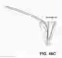 Fig. 40 - Suturing and repairing tissue using in vivo suture loading
