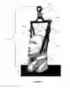 Fig. 08 - Dynamic logarithmic spinal decompression table and method