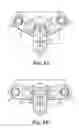 Fig. 06 - Variable geometry occipital fixation plate