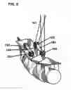 Fig. 07 - System and method for wire-guided pedicle screw stabilization of spinal vertebrae