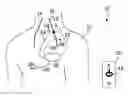 Fig. 01 - Method and apparatus to enhance therapy during stimulation of vagus nerve