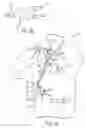 Fig. 04 - COMBINATION HEART ASSIST SYSTEMS, METHODS, AND DEVICES
