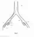 Fig. 07 - INTRODUCER FOR AN ILIAC SIDE BRANCH DEVICE