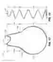 Fig. 09 - Mobile external coupling for branch vessel connection
