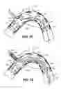 Fig. 19 - Mobile external coupling for branch vessel connection