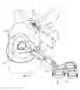 Fig. 09 - Mechanical Apparatus and Method for Artificial Disc Fusion and Nucleus Replacement