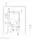 Fig. 04 - Compensation orthodontic archwire design