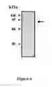 Fig. 07 - Procedure for producing transgenic plants providing high starch content and yield and high amylose/amylopectin balance