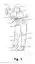 Fig. 02 - Articles of Apparel Providing Enhanced Body Position Feedback