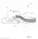 Fig. 02 - ADJUSTABLE CRADLE PILLOW SYSTEMS