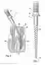 Fig. 02 - ENDODONTIC ROTARY INSTRUMENTS MADE OF SHAPE MEMORY ALLOYS IN THEIR MARTENSITIC STATE AND MANUFACTURING METHODS
