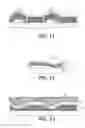 Fig. 07 - Printing system employing deformable polymer printing plates