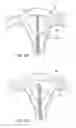 Fig. 03 - Intra uterine device