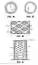Fig. 02 - Media compaction compensating support system for pollutant stream remediation reactors