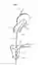 Fig. 09 - Load hook control device for a crane