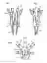 Fig. 02 - Calyx support for stemmed flowers