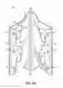 Fig. 04 - Outside wrap post coupler accommodating beam rivet