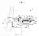 Fig. 08 - Wind turbine generator including air-cooled heat exchanger