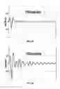 Fig. 07 - High frequency piezocomposite with triangular cross-sectional shaped pillars