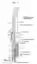 Fig. 02 - Spark plug for internal combustion engine