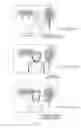 Fig. 04 - Imaging device, with blur enhancement