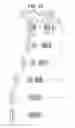 Fig. 23 - Zoom lens system, optical apparatus and method for manufacturing zoom lens system