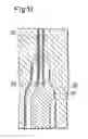 Fig. 09 - Device for dispensing a filling mass