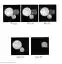 Fig. 05 - MAGNETIC RESONANCE IMAGING METHOD FOR ACHIEVING WATER-FAT SEPARATION