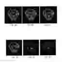 Fig. 06 - MAGNETIC RESONANCE IMAGING METHOD FOR ACHIEVING WATER-FAT SEPARATION