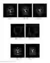 Fig. 07 - MAGNETIC RESONANCE IMAGING METHOD FOR ACHIEVING WATER-FAT SEPARATION