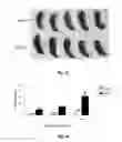 Fig. 07 - System for Modulating Expression of Hypothalmic Brain-Derived Neurotrophic Factor (BDNF)