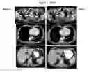 Fig. 06 - CANCER IMMUNOTHERAPY AND METHOD OF TREATMENT