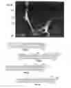 Fig. 06 - Implantable materials having engineered surfaces made by vacuum deposition and method of making same